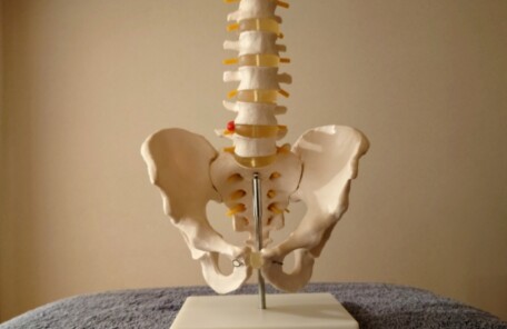 腰痛椎間板ヘルニア　鍼灸治療